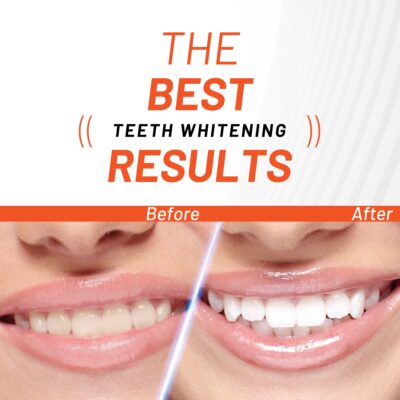 Bột làm trắng răng Than hoạt tính White Glo 30g 5